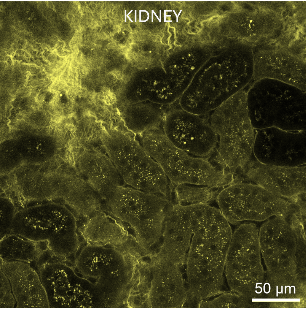 Use of Rhobo6 ECM Dye for labeling the extracellular matrix (ECM) in live kidney tissues.